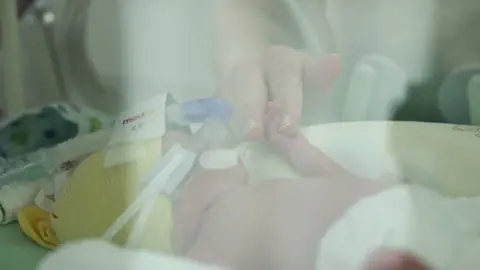 Kinderintensivstation KSGR Frühchen Neonatologie